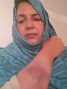 The Makhzen brutally attacks Sahrawi human rights activist Sultana Khaya and her family