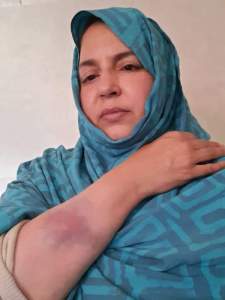 The Makhzen brutally attacks Sahrawi human rights activist Sultana Khaya and her family