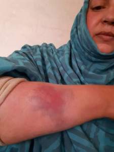 The Makhzen brutally attacks Sahrawi human rights activist Sultana Khaya and her family